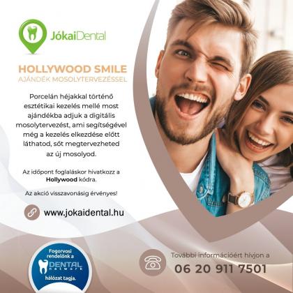 Hollywood smile Hollywood smile
