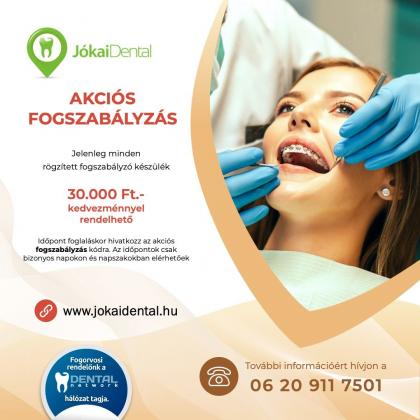 Teeth Alignment Offer Teeth Alignment Offer