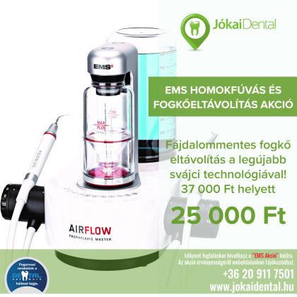 EMS Homokfúvás és Fogkőeltávolítás AKCIÓ! EMS Homokfúvás és Fogkőeltávolítás AKCIÓ!