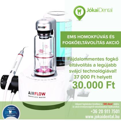 EMS Homokfúvás és Fogkőeltávolítás AKCIÓ!