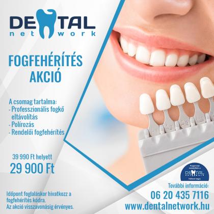 Tavaszi Fogfehérítés Akció Tavaszi Fogfehérítés Akció