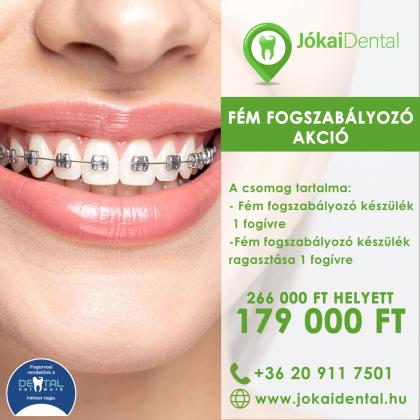 Fém Fogszabályozó Akció