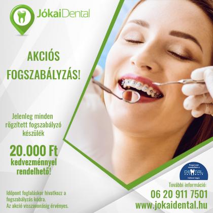 Fogszabályozás Akció Fogszabályozás Akció