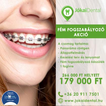 Fém Fogszabályozó Akció