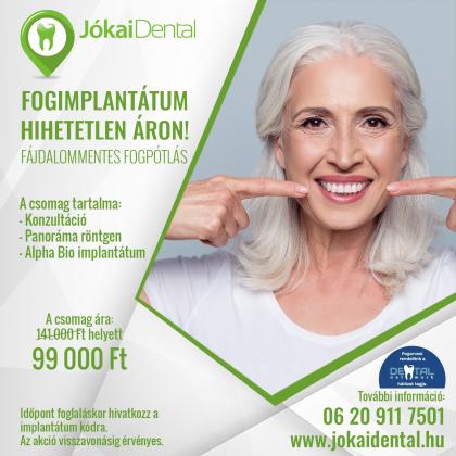 Dental Implant At An Amazing Price! Dental Implant At An Amazing Price!