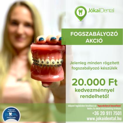Fogszabályozás AKCIÓ Fogszabályozás AKCIÓ