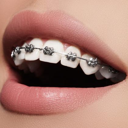Orthodontics are usually needed for cosmetic reasons