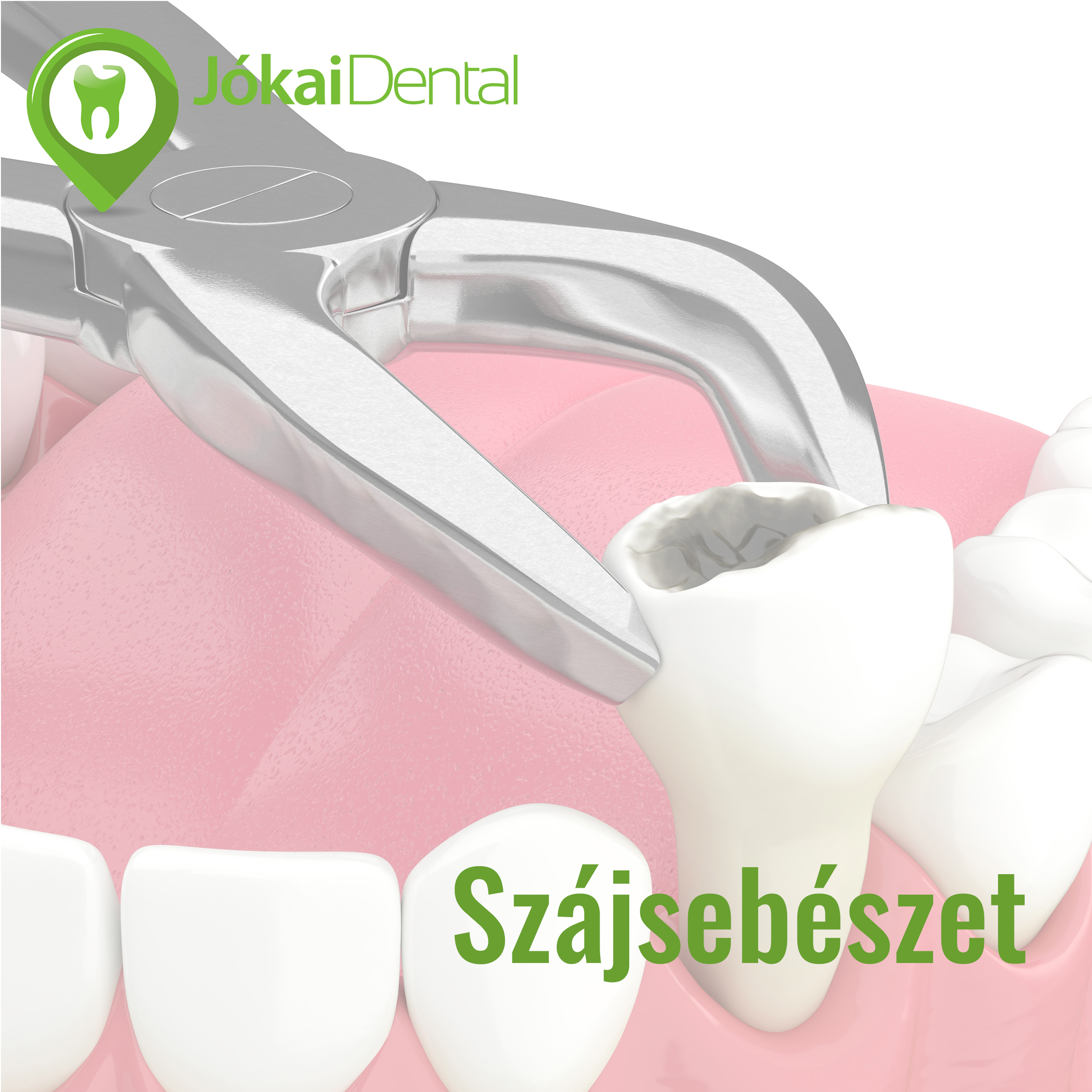 Oral Surgery Jókai Dental Fogászat Budapest