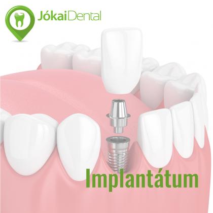 Implantology