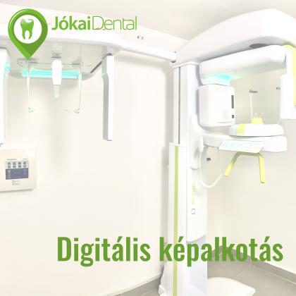 Digitális képalkotás - CT - Haifa Dent és Dentium Implant Centerben érhető el Digitális képalkotás - CT - Haifa Dent és Dentium Implant Centerben érhető el