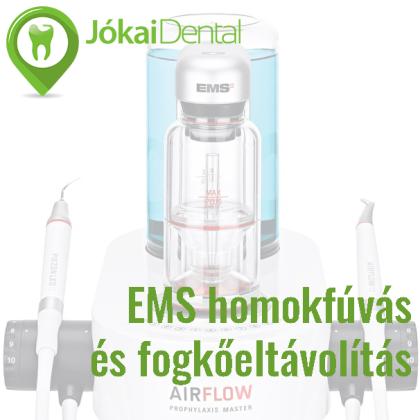 EMS homokfúvás és fogkőeltávolítás